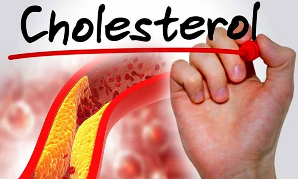 Heroes in Cholesterol Management