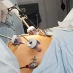 Breast Pumps: A Guide to Choosing the Right One for Your Needs