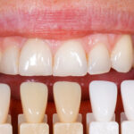 How Dentists Help Patients Manage Dental Anxiety