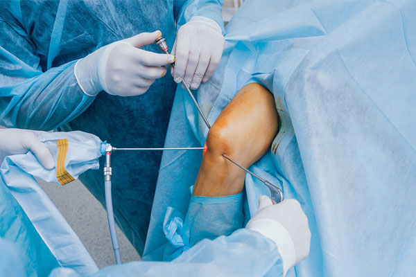 Orthopedic Surgery