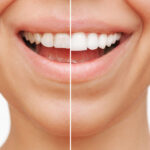 How Cosmetic Dentistry Creates the Perfect Smile