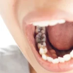 Why Indoor Swimming Pools Are Perfect for Exercising Regardless of Weather