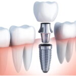 The Importance of Regular Dental Check-ups for Family Health