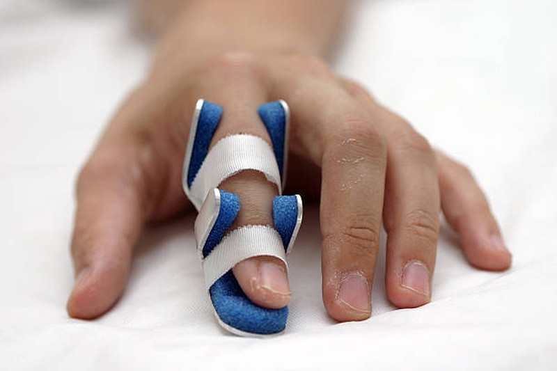 Finger Splints: Types, Uses and How to Choose the Right One